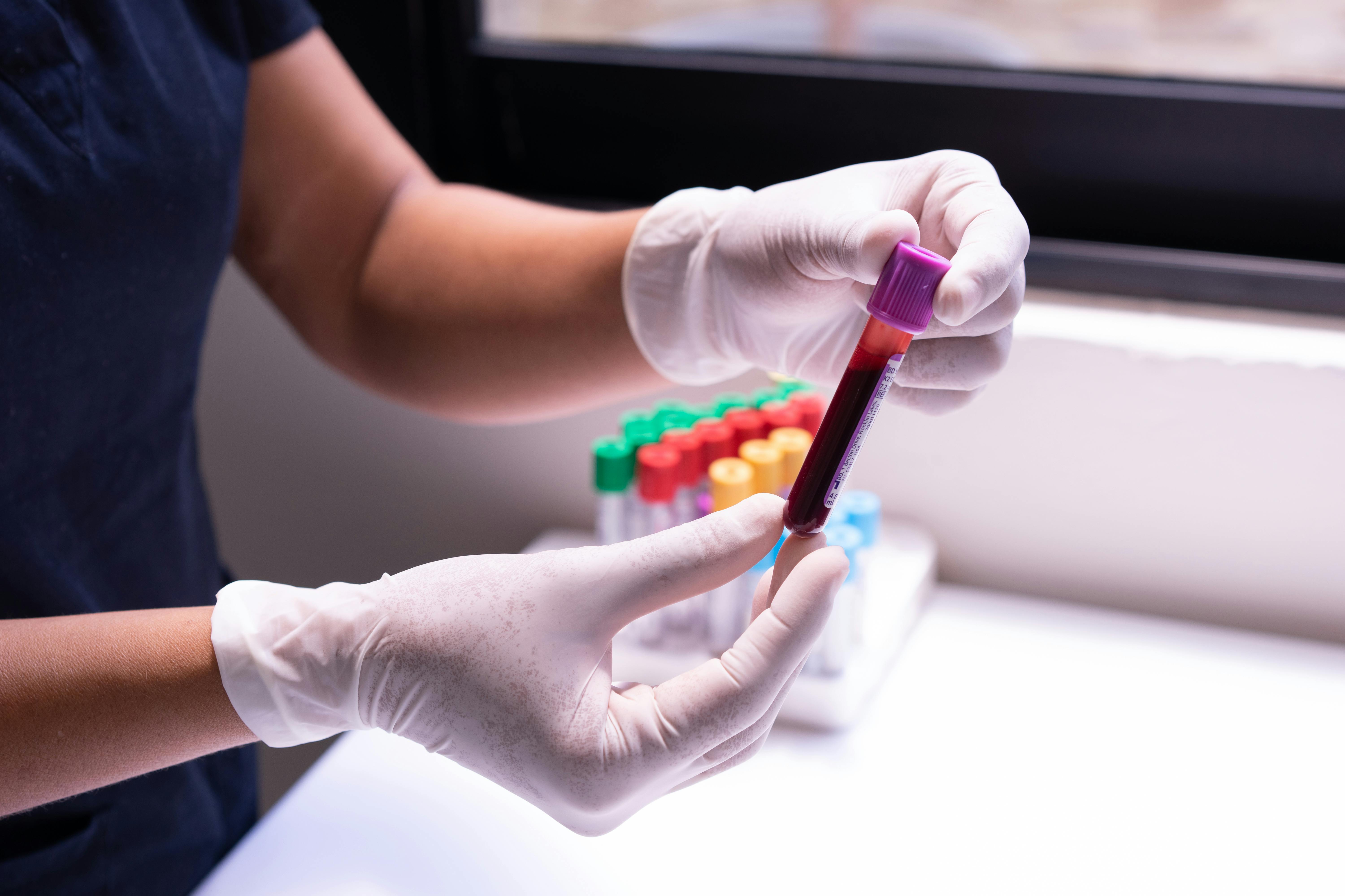 blood test